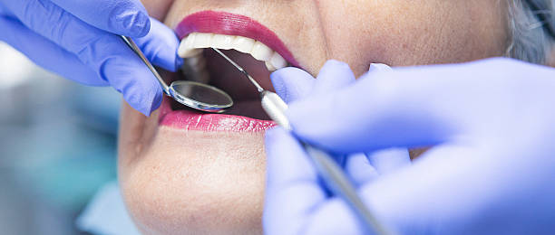 Best Emergency Wisdom Teeth Removal in Talahi Island, GA